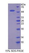 SLC1A5 / ASCT2 Protein - Recombinant  Solute Carrier Family 1, Member 5 By SDS-PAGE