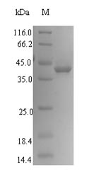 SLC1A6 / EAAT4 Protein - (Tris-Glycine gel) Discontinuous SDS-PAGE (reduced) with 5% enrichment gel and 15% separation gel.