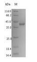 SLC1A6 / EAAT4 Protein - (Tris-Glycine gel) Discontinuous SDS-PAGE (reduced) with 5% enrichment gel and 15% separation gel.
