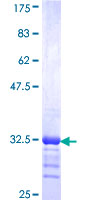 SLC1A6 / EAAT4 Protein - 12.5% SDS-PAGE Stained with Coomassie Blue.