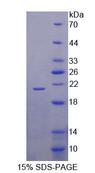 SLC1A6 / EAAT4 Protein - Recombinant Excitatory Amino Acid Transporter 4 By SDS-PAGE