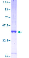 SLC1A7 / EAAT5 Protein - 12.5% SDS-PAGE of human SLC1A7 stained with Coomassie Blue