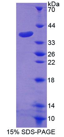 SLC20A1 Protein - Recombinant Gibbon Ape Leukemia Virus Receptor 1 (GLVR1) by SDS-PAGE