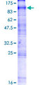 SLC20A2 / PIT2 Protein - 12.5% SDS-PAGE of human SLC20A2 stained with Coomassie Blue