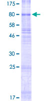 SLC22A11 Protein - 12.5% SDS-PAGE of human SLC22A11 stained with Coomassie Blue