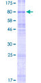 SLC22A11 Protein - 12.5% SDS-PAGE of human SLC22A11 stained with Coomassie Blue