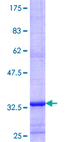 SLC22A11 Protein - 12.5% SDS-PAGE Stained with Coomassie Blue.