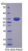SLC22A11 Protein - Recombinant Solute Carrier Family 22, Member 11 (SLC22A11) by SDS-PAGE