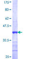 SLC22A13 Protein - 12.5% SDS-PAGE Stained with Coomassie Blue.