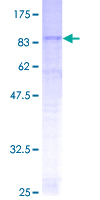 SLC22A17 Protein - 12.5% SDS-PAGE of human SLC22A17 stained with Coomassie Blue