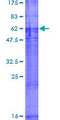 SLC22A18 Protein - 12.5% SDS-PAGE of human SLC22A18 stained with Coomassie Blue