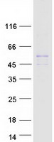 SLC22A18 Protein - Purified recombinant protein SLC22A18 was analyzed by SDS-PAGE gel and Coomassie Blue Staining