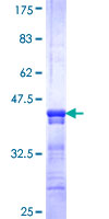 SLC22A18AS Protein - 12.5% SDS-PAGE Stained with Coomassie Blue.