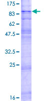 SLC22A2 Protein - 12.5% SDS-PAGE of human SLC22A2 stained with Coomassie Blue