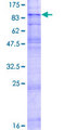 SLC22A2 Protein - 12.5% SDS-PAGE of human SLC22A2 stained with Coomassie Blue