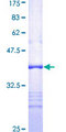 SLC22A2 Protein - 12.5% SDS-PAGE Stained with Coomassie Blue.