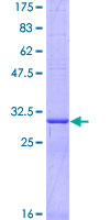 SLC22A3 / OCT3 Protein - 12.5% SDS-PAGE Stained with Coomassie Blue.