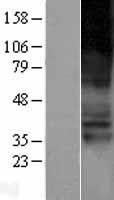 SLC22A4 / OCTN1 Protein - Western validation with an anti-DDK antibody * L: Control HEK293 lysate R: Over-expression lysate