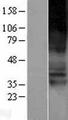 SLC22A4 / OCTN1 Protein - Western validation with an anti-DDK antibody * L: Control HEK293 lysate R: Over-expression lysate