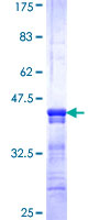 SLC22A4 / OCTN1 Protein - 12.5% SDS-PAGE Stained with Coomassie Blue.