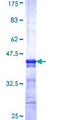 SLC22A4 / OCTN1 Protein - 12.5% SDS-PAGE Stained with Coomassie Blue.