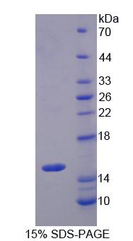 SLC22A4 / OCTN1 Protein - Recombinant  Organic Cation/Ergothioneine Transporter By SDS-PAGE