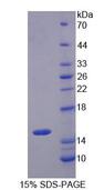 SLC22A4 / OCTN1 Protein - Recombinant  Organic Cation/Ergothioneine Transporter By SDS-PAGE