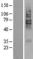 SLC22A5 / OCTN2 Protein - Western validation with an anti-DDK antibody * L: Control HEK293 lysate R: Over-expression lysate