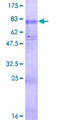 SLC22A5 / OCTN2 Protein - 12.5% SDS-PAGE of human SLC22A5 stained with Coomassie Blue