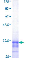 SLC22A5 / OCTN2 Protein - 12.5% SDS-PAGE Stained with Coomassie Blue.