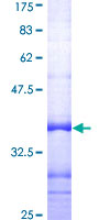 SLC22A6 / OAT1 Protein - 12.5% SDS-PAGE Stained with Coomassie Blue.