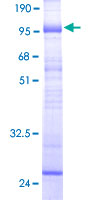 SLC22A7 / OAT2 Protein - 12.5% SDS-PAGE of human SLC22A7 stained with Coomassie Blue