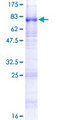 SLC22A8 / OAT3 Protein - 12.5% SDS-PAGE of human SLC22A8 stained with Coomassie Blue