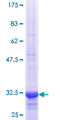 SLC22A8 / OAT3 Protein - 12.5% SDS-PAGE Stained with Coomassie Blue.
