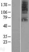 SLC22A9 / OAT7 Protein - Western validation with an anti-DDK antibody * L: Control HEK293 lysate R: Over-expression lysate