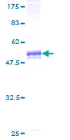 SLC23A1 / SVCT1 Protein - 12.5% SDS-PAGE of human SLC23A1 stained with Coomassie Blue