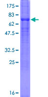 SLC23A2 / SVCT2 Protein - 12.5% SDS-PAGE of human SLC23A2 stained with Coomassie Blue