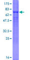 SLC23A2 / SVCT2 Protein - 12.5% SDS-PAGE of human SLC23A2 stained with Coomassie Blue