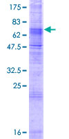 SLC24A5 / NCKX5 Protein - 12.5% SDS-PAGE of human SLC24A5 stained with Coomassie Blue