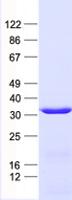 SLC25A1 / SEA Protein