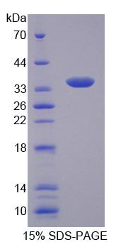 SLC25A1 / SEA Protein - Recombinant Citrate Transporter Protein, Mitochondrial (CTP) by SDS-PAGE