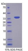 SLC25A1 / SEA Protein - Recombinant Citrate Transporter Protein, Mitochondrial (CTP) by SDS-PAGE