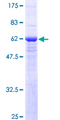 SLC25A11 Protein - 12.5% SDS-PAGE of human SLC25A11 stained with Coomassie Blue