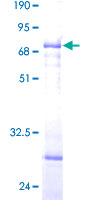 SLC25A11 Protein - 12.5% SDS-PAGE of human SLC25A11 stained with Coomassie Blue