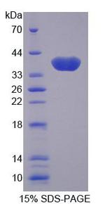 SLC25A11 Protein - Recombinant Oxoglutarate Carrier Protein, Mitochondrial (OGC) by SDS-PAGE