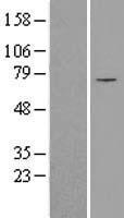 SLC25A12 / ARALAR Protein - Western validation with an anti-DDK antibody * L: Control HEK293 lysate R: Over-expression lysate