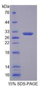 SLC25A12 / ARALAR Protein - Recombinant Aspartate Glutamate Carrier Isoform 1, Mitochondrial (Agc1) by SDS-PAGE