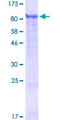 SLC25A13 / CITRIN Protein - 12.5% SDS-PAGE of human SLC25A13 stained with Coomassie Blue