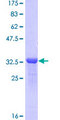 SLC25A13 / CITRIN Protein - 12.5% SDS-PAGE Stained with Coomassie Blue.