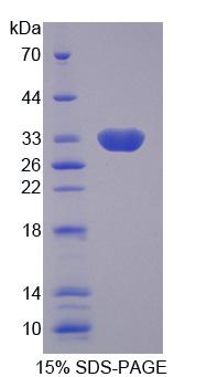 SLC25A13 / CITRIN Protein - Recombinant Solute Carrier Family 25 Member 13 (SLC25A13) by SDS-PAGE